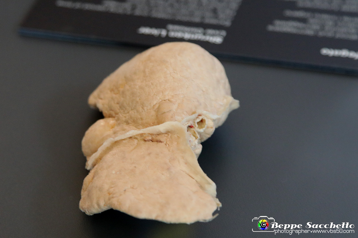 VBS_2720 - Cirrosi epatica - Mostra Body Worlds.jpg
